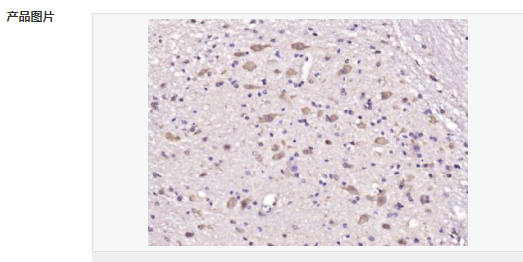 605839d0d8b19.png image.png