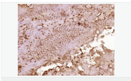 605940306aea3.png image.png