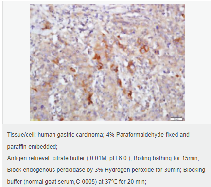 60594336a7f3b.png image.png