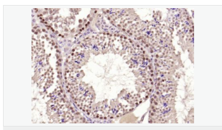 605952209f9b1.png image.png