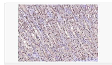 6066d47d45b71.png image.png