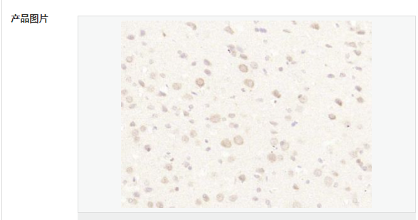 6076a727861c8.png image.png